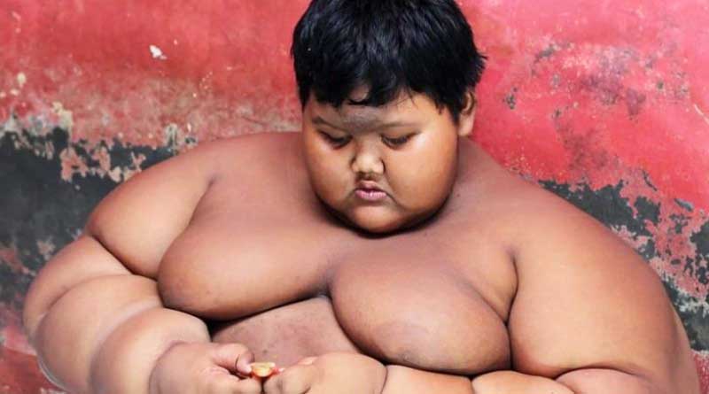World’s fattest boy, weighing 192 kilos, put on crash diet