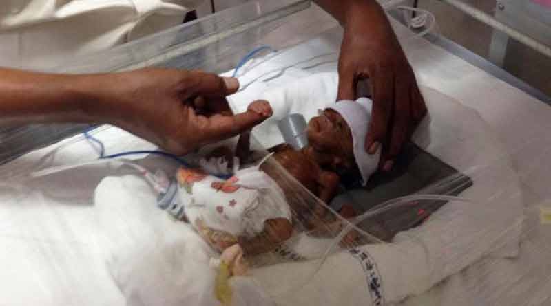 the preemie weighed baby then a hospital worked its magic
