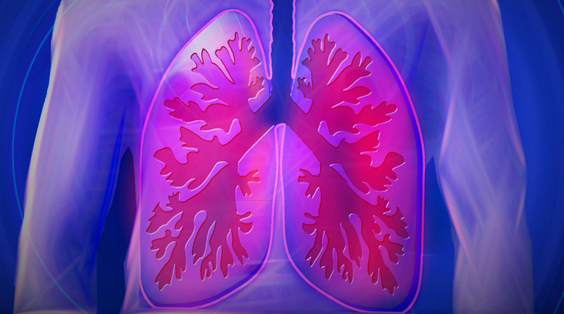 Lungs Diseases: Symptoms and Remedy