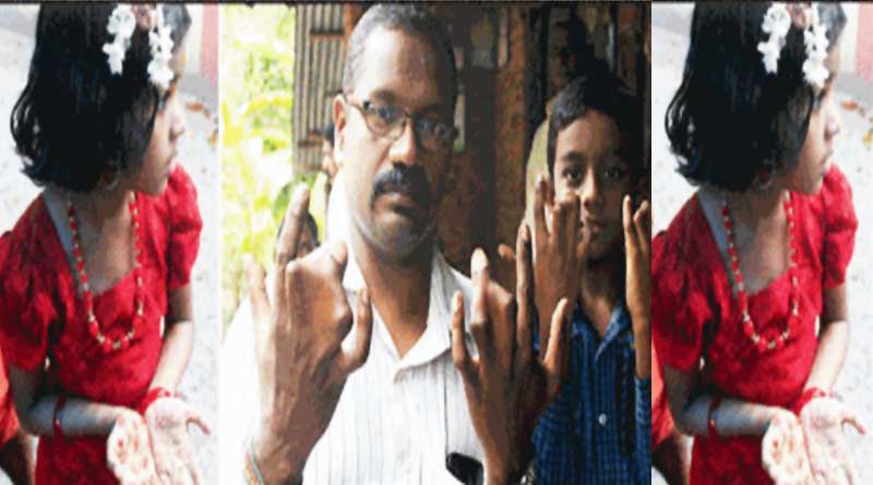 হাতে ‘ঈশ্বরের আশীর্বাদ’ নিয়ে দিন কাটাচ্ছে এই পরিবার!