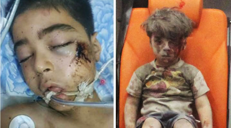 Brother of Aleppo boy dies