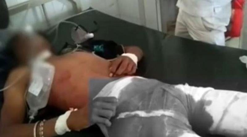 Lying in bloodpool, karnataka teen cried for help; people filmed him instead