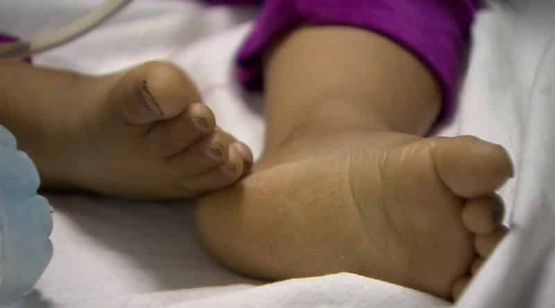 Bengal girl child abused with needles dies at SSKM Hospital