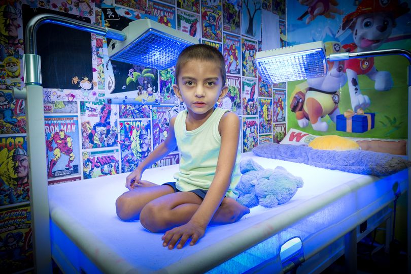 Child with rare liver disease has to spend 20 hours in bright blue light