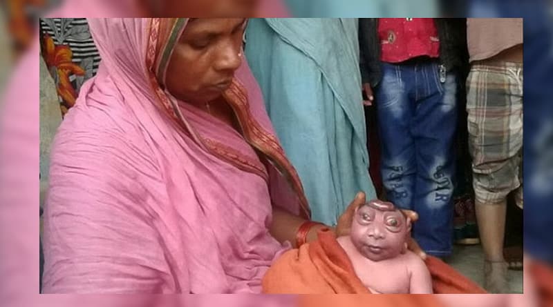 Bihar woman refuses to nurse 'alien' looking baby 