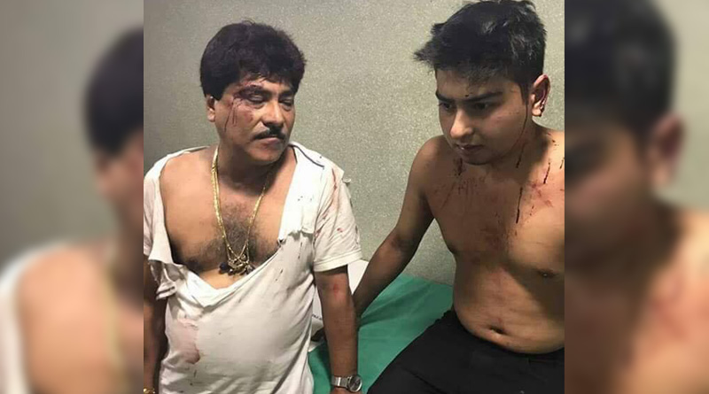 বেপরোয়া গাড়ি, প্রতিবাদ করায় প্রহৃত টলিউড অভিনেতা