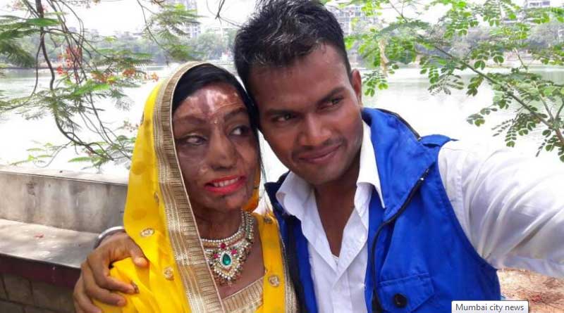 অ্যাসিড হামলার স্মৃতি অতীত, বিয়ে করে নতুন জীবনে প্রবেশ এই যুবতীর