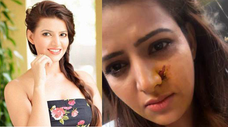 OMG! এই অভিনেত্রীকে করাত দিয়ে আঘাত অভিনেতার!