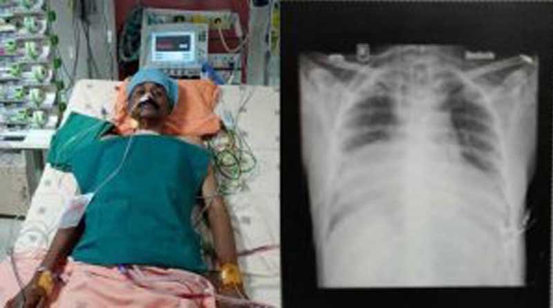 Kerala man is the first in country to live with two beating hearts 