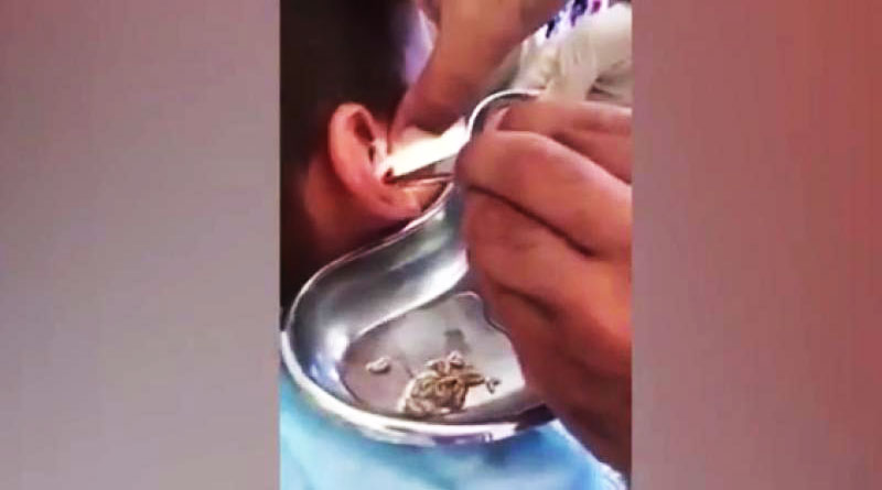 সেকি! কিশোরের কান থেকে এসব কী বেরল?