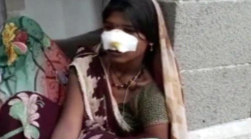 ‘বাঁধা শ্রমিক’ হিসেবে কাজ করতে নারাজ, নাক কাটা হল মহিলার