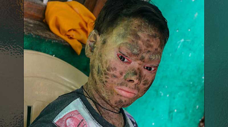 সাপের মতো প্রতি ৪৫ দিন অন্তর ‘খোলস’ বদলায় এই ‘সর্পকন্যা’