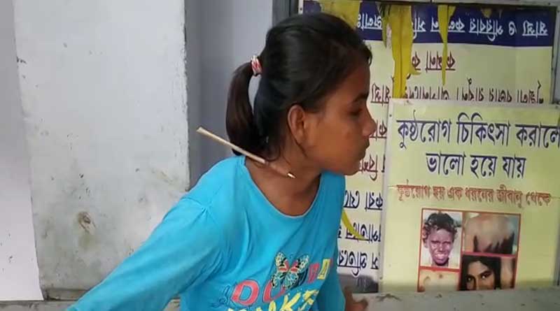 অনুশীলনে লক্ষ্যভ্রষ্ট তির বিঁধল প্রতিযোগীর গলায়, সংকটে খুদে তিরন্দাজ