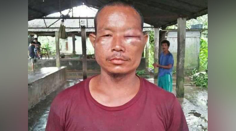উন্নয়ন নিয়ে প্রশ্নে মেজাজ হারালেন বিধায়ক, প্রশ্নকর্তাকে বেদম প্রহার