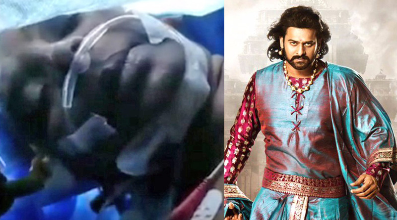 Watch: Patient watches 'Baahubali 2' as doctors operate on her brain