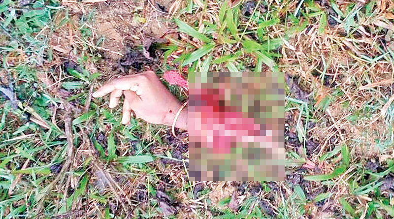 রাস্তায় চুড়ি পরা মহিলার কাটা হাত! তীব্র চাঞ্চল্য বালুরঘাটে