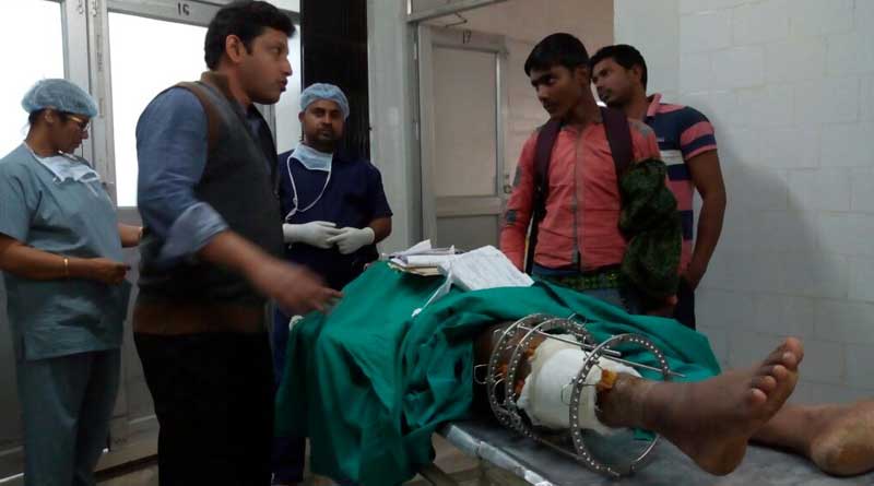 পায়ের হাড় ভেঙে টুকরো টুকরো, অস্ত্রোপচার ছাড়াই জুড়ল হাসপাতাল