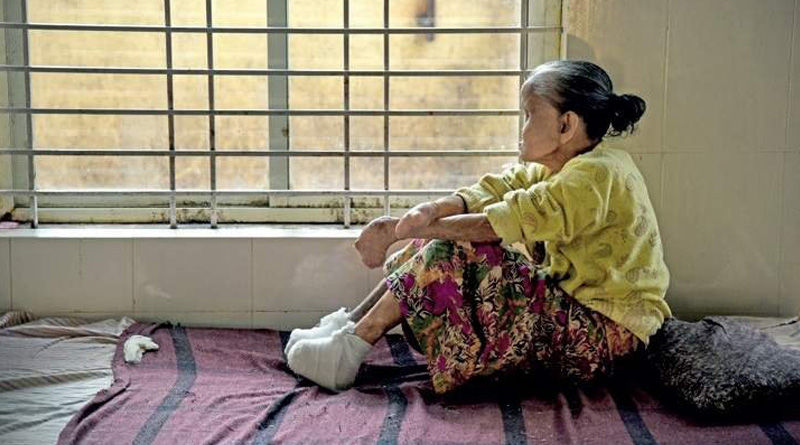 Leprosy Patient Was Denied Pension As She Has No Fingers Or Iris For Aadhaar Card