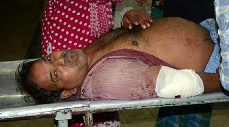 A businessman Shoot at Barrackpore, Admitted in Hospital