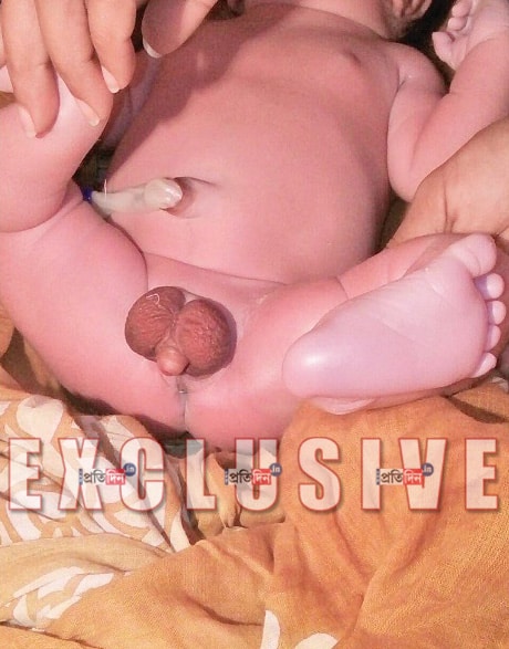 Andakosh-Baby-1