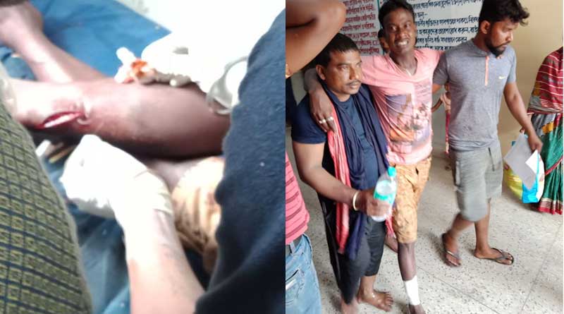দিঘার সমুদ্রে নেমে দুর্ঘটনার কবলে, স্পিডবোটের ধাক্কায় জখম ২ পর্যটক