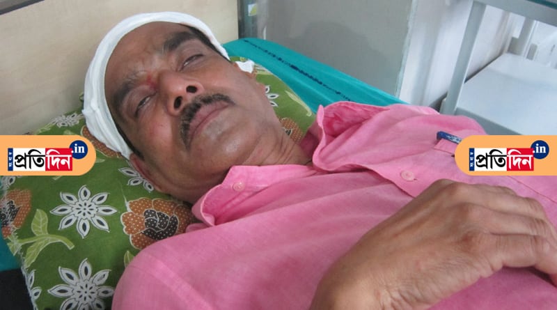 গম ভাঙানো নিয়ে বচসা, বাটখারার ঘায়ে জখম খোদ পুলিশ আধিকারিক