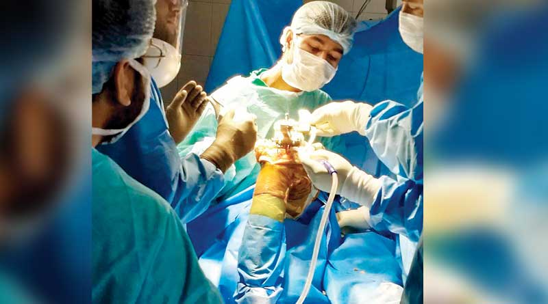 Successful Nee transplant surgery at Burdwan Medical college, doctors set Example