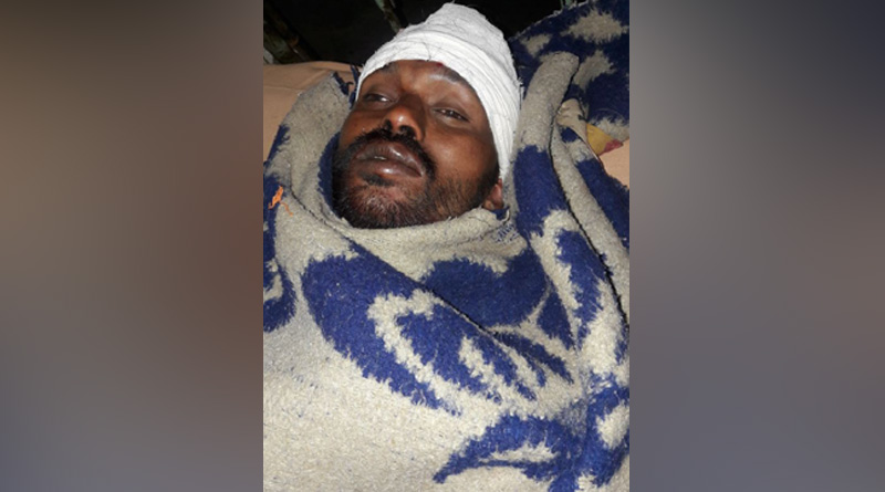 ভোট পরবর্তী হিংসা, ভাইপোকে হাসপাতালে ভরতি করতে এসে মাথা ফাটল কাকার