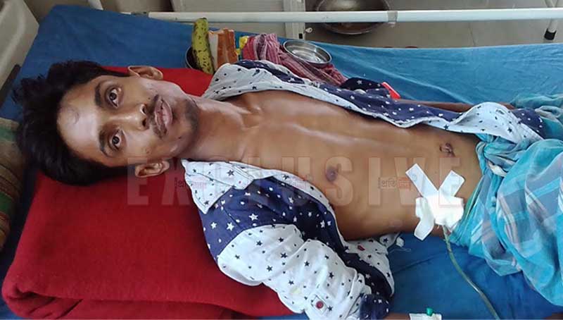 দুর্ঘটনায় লিভারে ফাটল, পেটের জমাট রক্ত সরিয়ে যুবকের প্রাণ বাঁচালেন চিকিৎসক