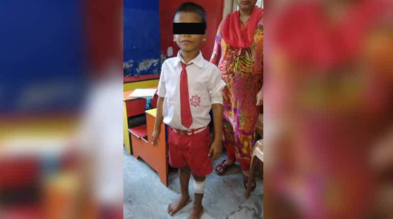 পড়া না পারার ‘অপরাধ’, বেলুড়ে খুদে ছাত্রের গায়ে গরম খুন্তির ছেঁকা শিক্ষিকার