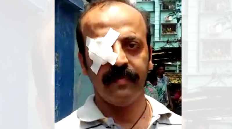 পরিবেশ দূষণের প্রতিবাদ করে প্রহৃত যুবক, চাঞ্চল্য উত্তরপাড়ায়