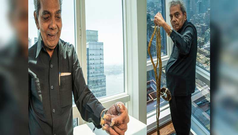 Man with world's longest nails gets a manicure after decades