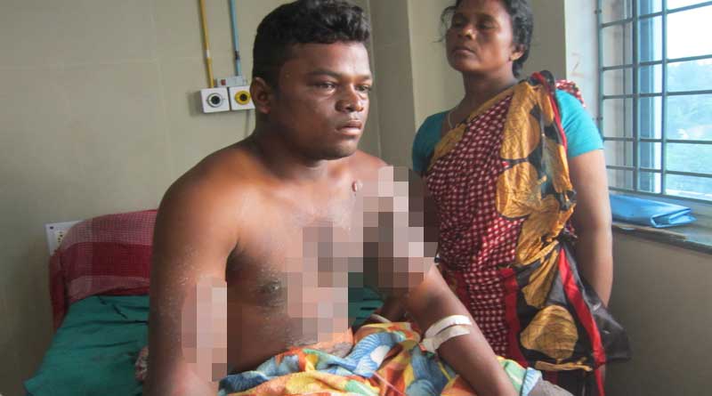 প্রতিবাদের মাশুল, বিয়েবাড়িতে ফুটন্ত ভাতের কড়াইয়ে ফেলে দেওয়া হল যুবককে