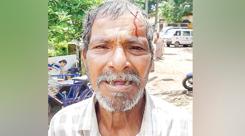 South 24 Parganas: Son bites Old man over family dispute