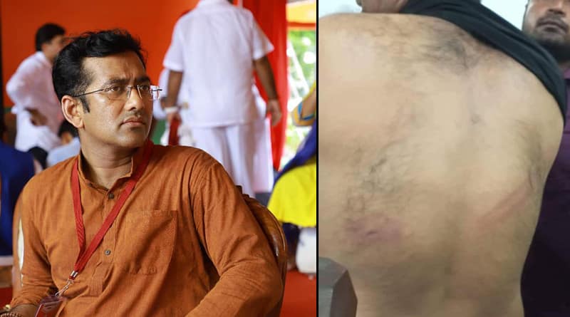 Islampur: BJYM State President Debjit Sarkar allegedly beaten in Police Custody