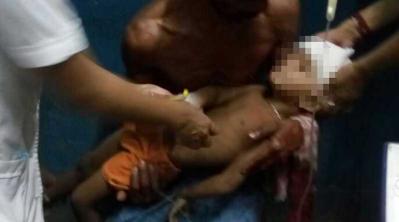 injured child Of Malda brought to Kolkata,admitted in SSKM