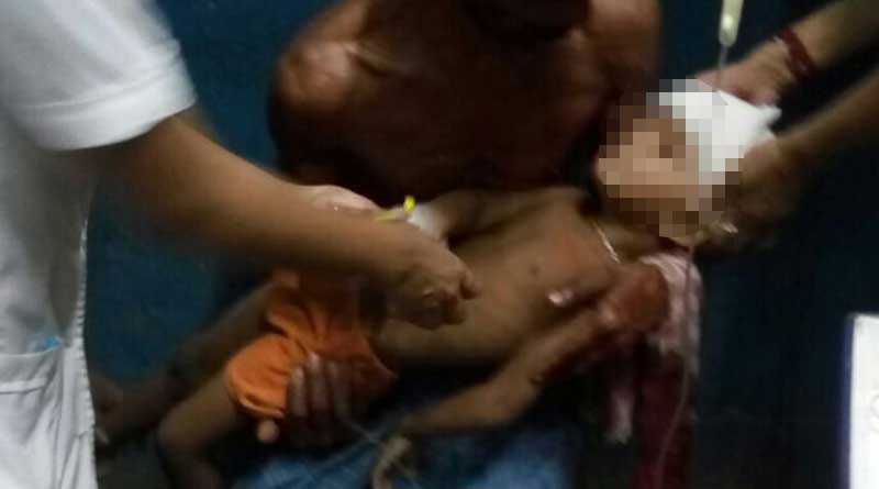 মানিকচকে গুলিবিদ্ধ শিশুকে আনা হল শহরে, এসএসকেএম-এ ভরতিতে হয়রানি