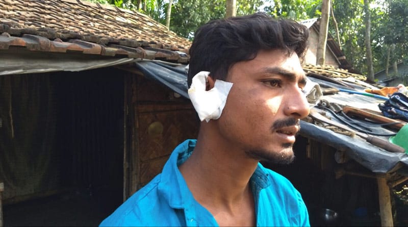 পাওনা টাকা চাইতেই বন্ধুর কানে কামড় যুবকের!