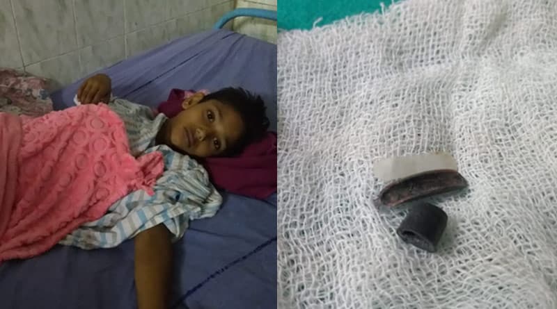 বাঁশি গিলে বিপত্তি! শিশুর প্রাণ বাঁচালেন মেডিক্যাল কলেজের চিকিৎসকরা