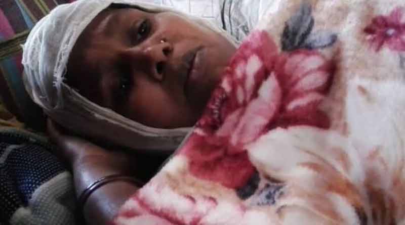 মাংস-পোলাও না পেয়ে বধূকে কুপিয়ে খুনের চেষ্টা শ্বশুরের