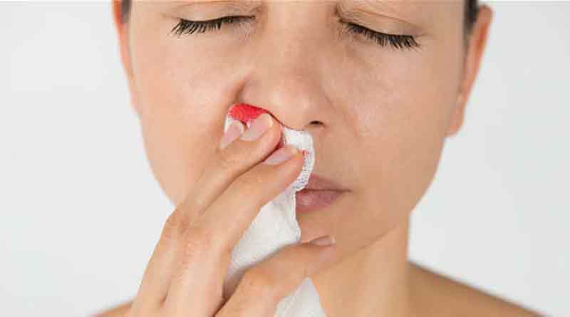 Prescription for nose bleeding