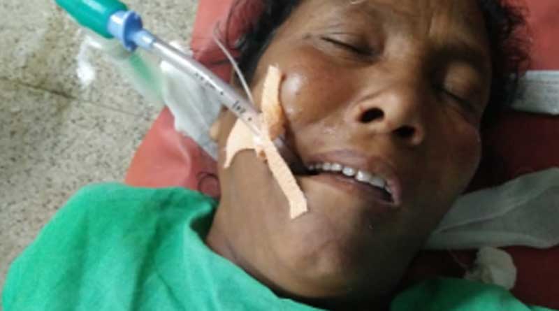তিনদিন গলায় আটকে মাংসের হাড়, মহিলাকে বাঁচাল সিউড়ির হাসপাতাল
