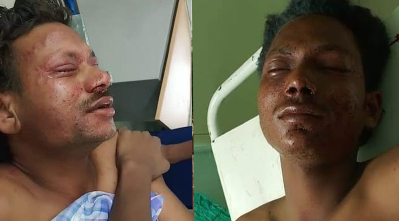 ইটাহারে বোমা বাঁধতে গিয়ে জখম তিন বিজেপি সমর্থক, এলাকায় উত্তেজনা