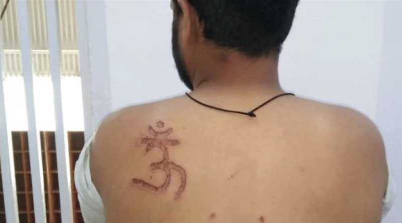 Muslim man branded with Om symbol, denied food by Tihar jail officials
