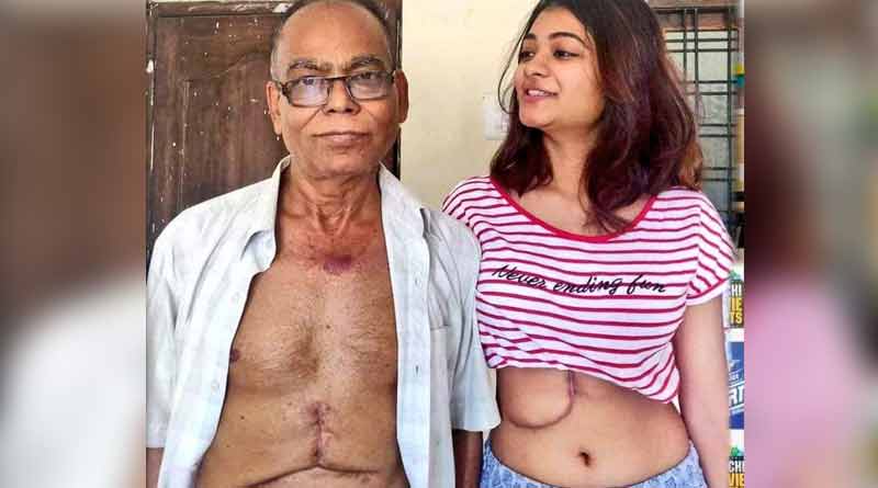 লিভারের ৬৫ শতাংশ বাবাকে দান, তরুণীর সাহসকে কুর্নিশ নেটদুনিয়ার