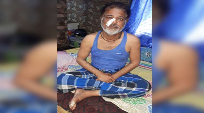চাঁদা দিতে অস্বীকার, ব্যবসায়ীকে বেধড়ক মার পুজো উদ্যোক্তাদের