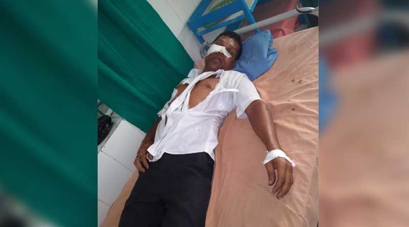TMC worker brutally beaten at Tehatta in Nadia district