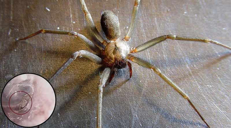 China: Doctors find spider building a nest inside youth’s ear