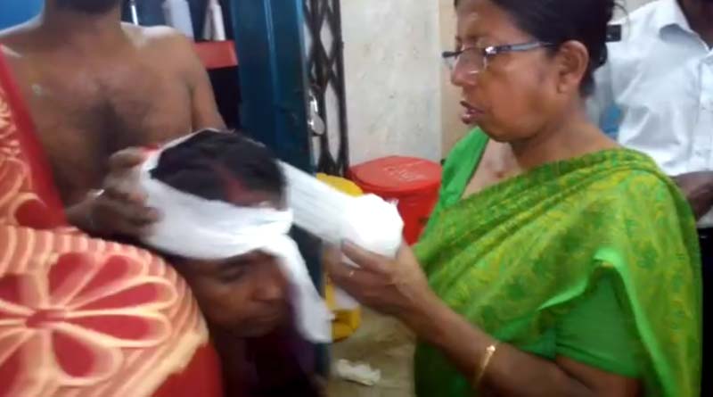 ‘জয় শ্রীরাম’ বলায় এক মহিলাকে কুড়ুলের কোপ, কাঠগড়ায় তৃণমূল