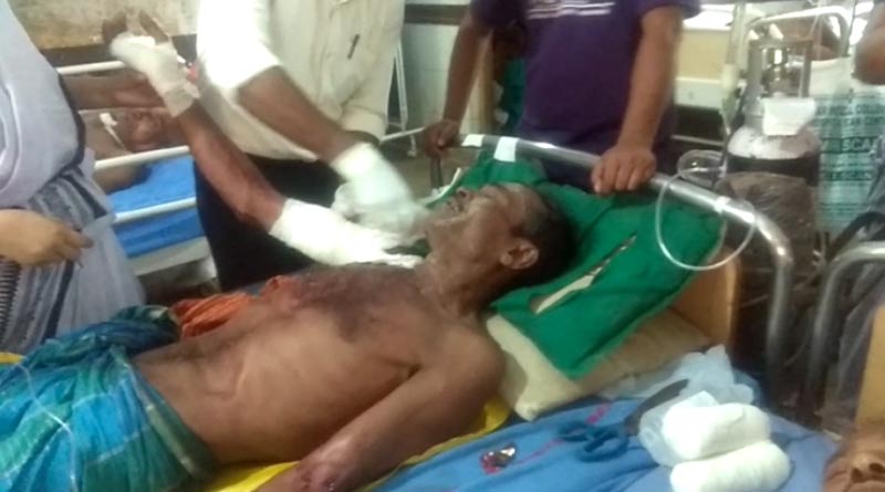 পুকুর খোঁড়ার সময় বোমা বিস্ফোরণ, আহত ১ শ্রমিক